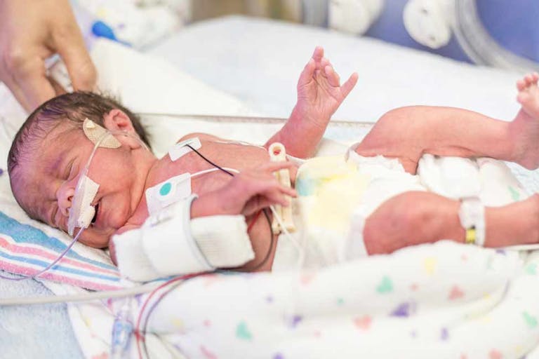 preemie, late-term abortion, abortion survivors, premature