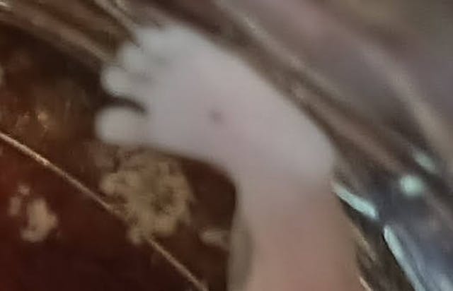 Photo of Jireh’s foot at 10 weeks and one day. Photo courtesy of Maria. Do not reprint. Mom shares images of 10-week miscarried twins, refuting Guardian’s ‘pregnancy tissue’ farce image