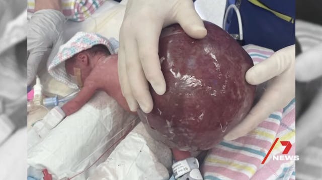 Screenshot News 7 baby, Saylor Thomson