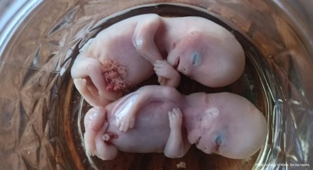 Mom shares images of 10-week miscarried twins, refuting Guardian’s ‘pregnancy tissue’ farce image