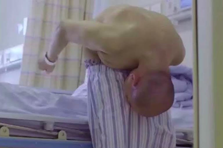 folded man, China, surgery