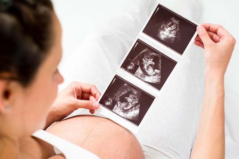 Roe v. Wade, ultrasound