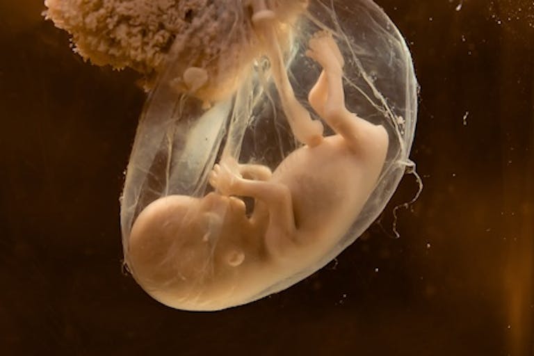 preborn-human