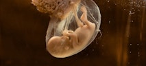 preborn-human