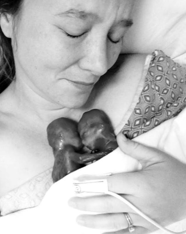 Amanda Powell holds her premature identical twins Walker and Clark. Amanda Powell holds her premature identical twins Walker and Clark.