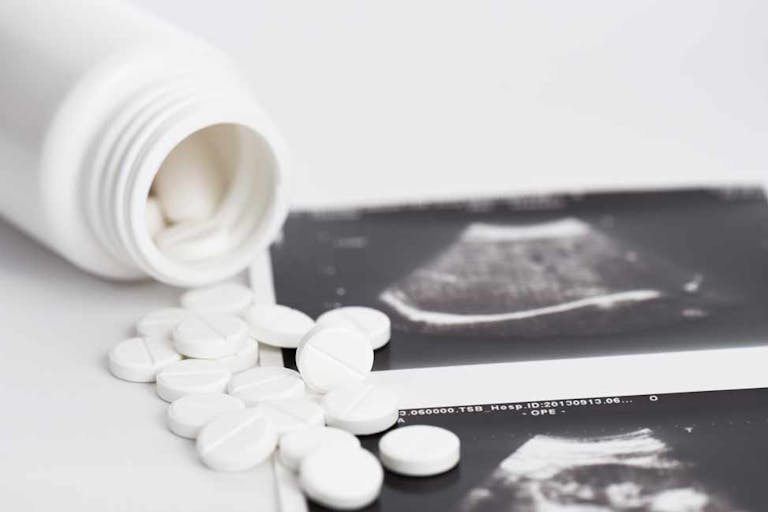 abortion pill reversal northern ireland, ireland
