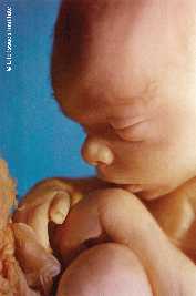 20 week baby in the womb