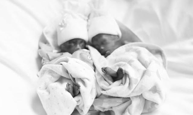 Walker and Clark, premature identical twins born too early to survive outside the womb.
