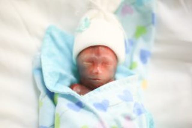 Mother shares powerful photos of identical twins miscarried at 19 weeks image