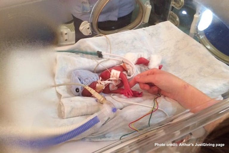 Arthur Brumby, 23 weeks, premature