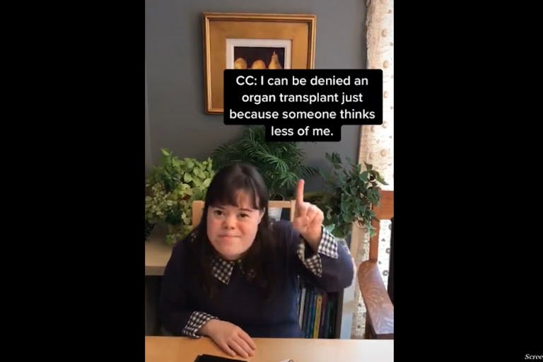 Down syndrome