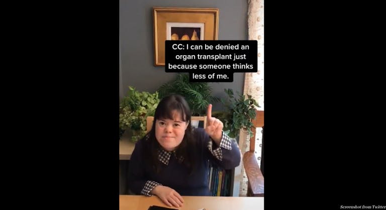 Down syndrome