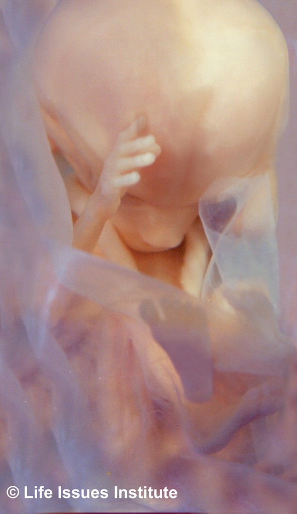 I aborted a child due to incest. To this day, I still deeply mourn the loss of my baby. image