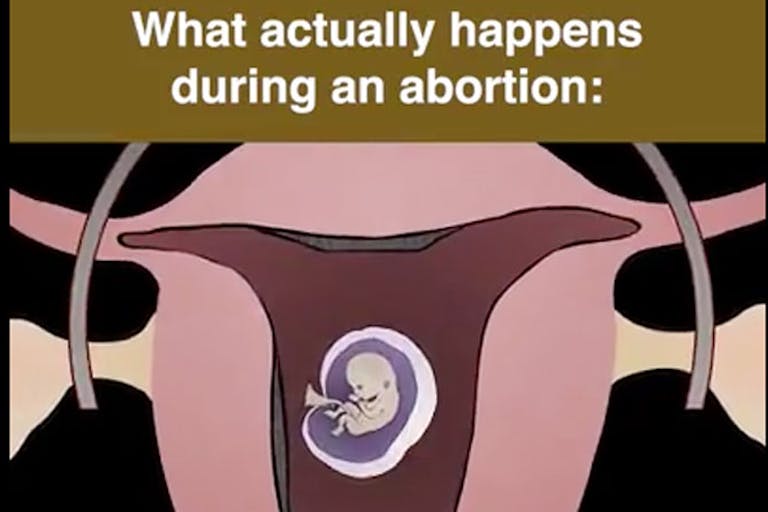 live-action-abortion-pill-video