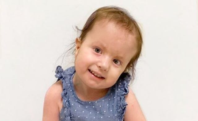 Evelyn trisomy 18 2