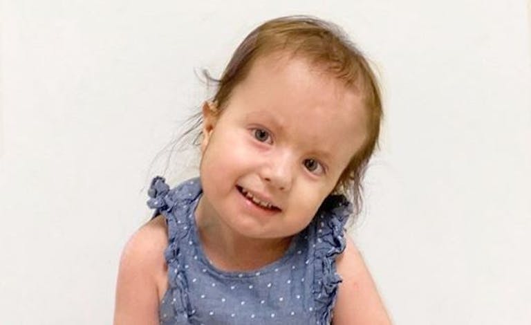 Evelyn trisomy 18 2