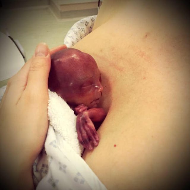 Premature baby girl Autumn. Facebook. Premature baby girl Autumn.