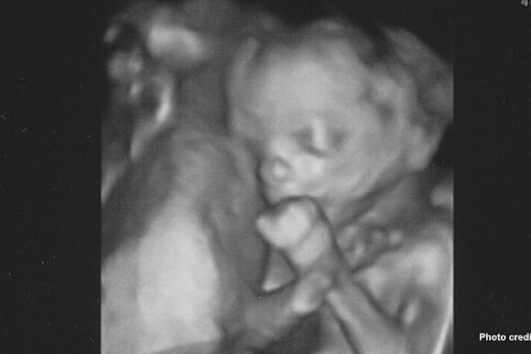 Baby Ella sucks her thumb at 19 weeks