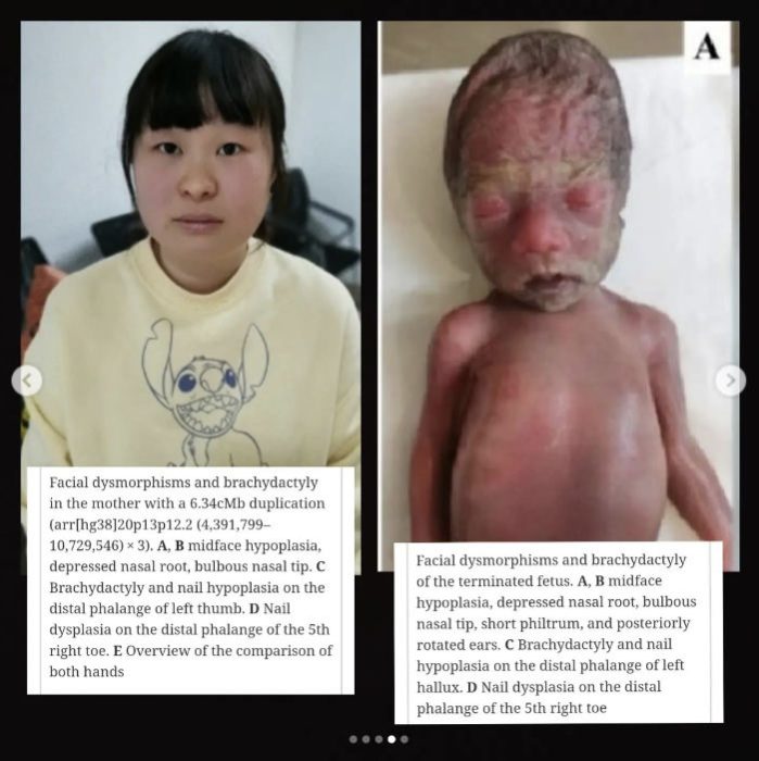 Study reveals heartbreaking images of baby girl aborted at 26 weeks image