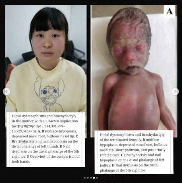 Study reveals heartbreaking images of baby girl aborted at 26 weeks image