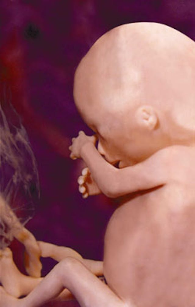 Women who had abortions recall the lies they were told about their preborn children image