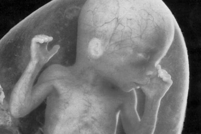 fetus, abortion, fetal tissue