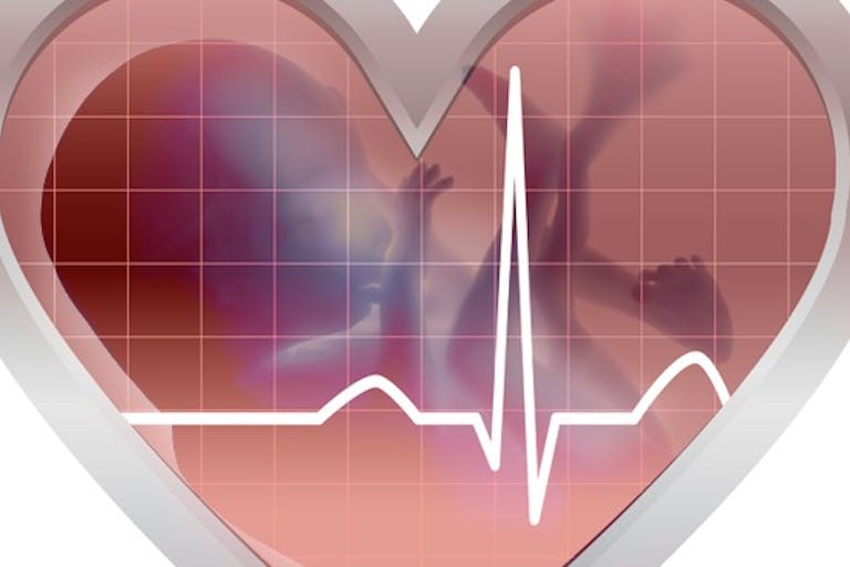 heartbeat-baby