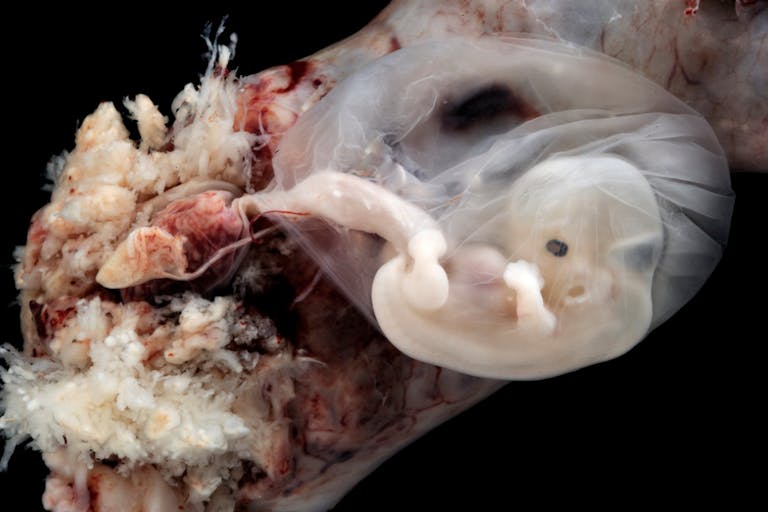 6-7 weeks EGA from conception