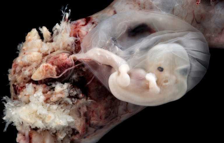 6-7 weeks EGA from conception