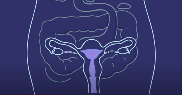 AMAZE screenshot of developing baby inside a uterus Planned Parenthood sex-ed partner promotes abortion pill to 10-year-olds image