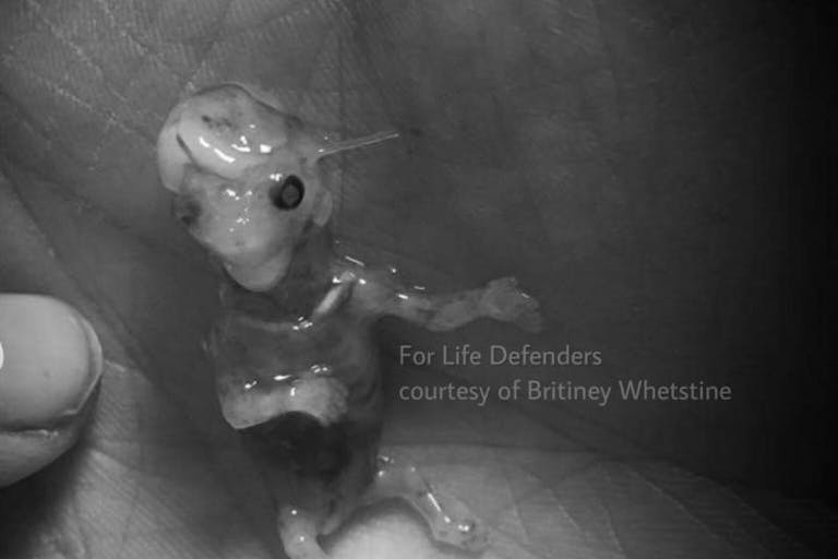 Hayden Ray Whetstine, 10 weeks gestation miscarriage