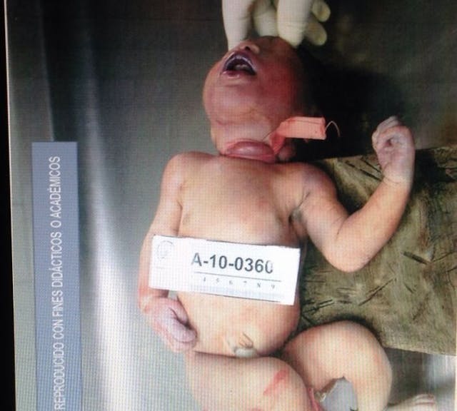 Newborns in El Salvador were stabbed and strangled… but media claims mothers were jailed for ‘miscarriage’ image