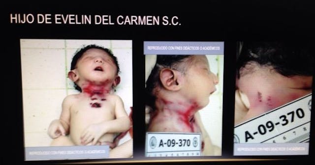 EXCLUSIVE: Undercover video shows Virginia abortionist saying it’s ‘easy’ to dismember babies image