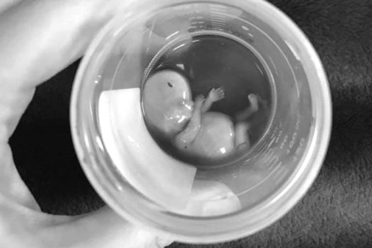 jaelyn-barnes-11-week-baby-525×700