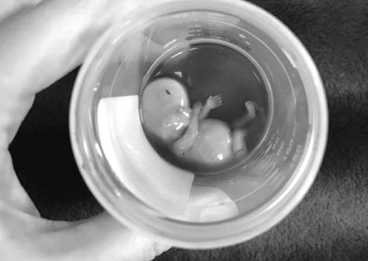 jaelyn-barnes-11-week-baby-525×700