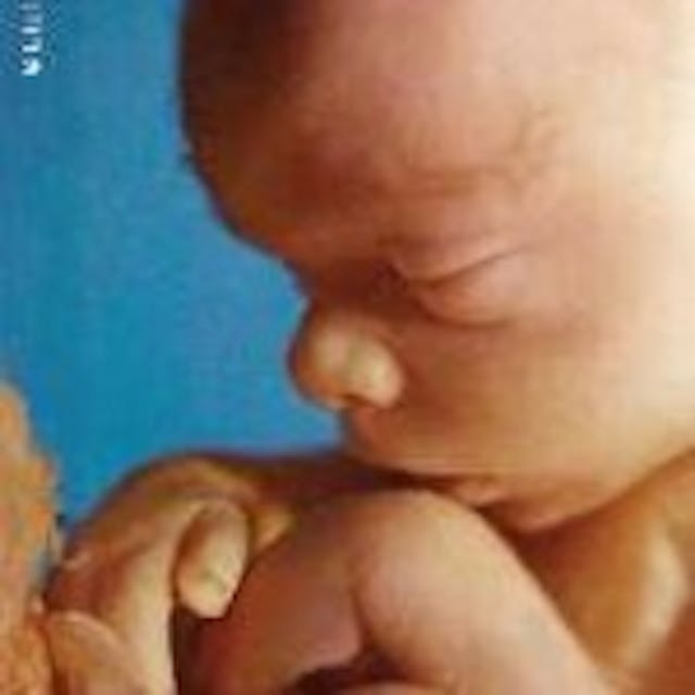 20 weeks