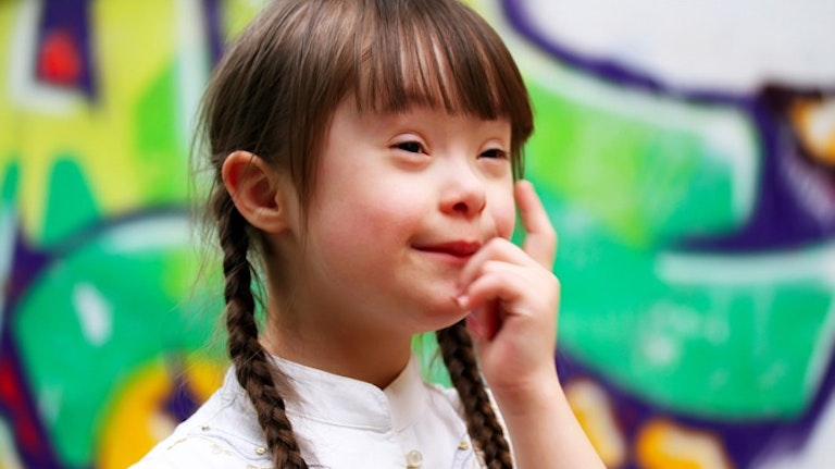 child-downs-syndrome