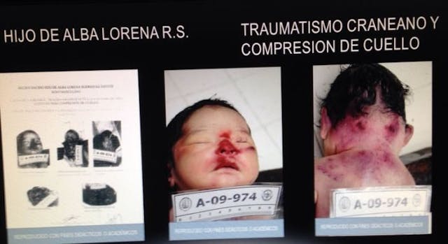 Son of Alba Lorena Rodríguez Santos, who was murdered after his birth. (VidaSV.org) Newborns in El Salvador were stabbed and strangled… but media claims mothers were jailed for ‘miscarriage’ image