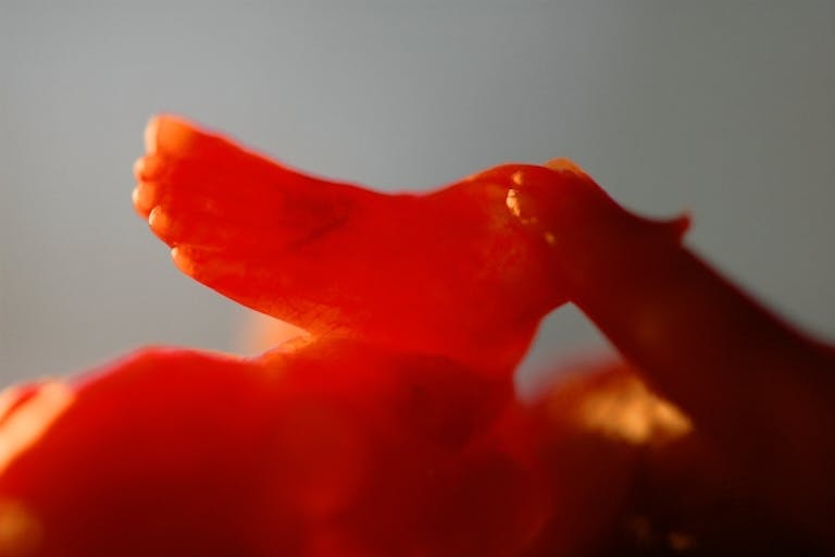 Foot of a baby aborted at 16 weeks. From Citizens for a Pro-Life Society Foot of baby aborted at 16 weeks. From Citizens for a Pro-Life Society