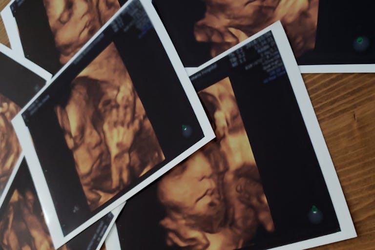 fetal pain