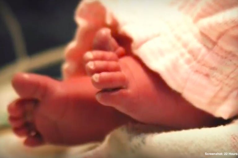 22 hours of grace anencephaly