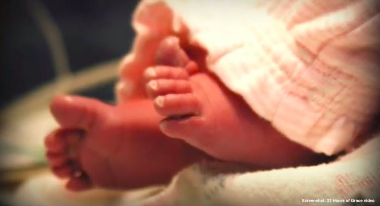 22 hours of grace anencephaly