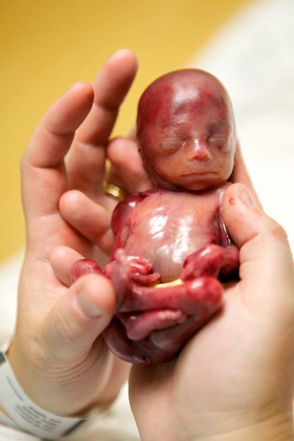 Walter Joshua Fretz who lived 19 weeks.