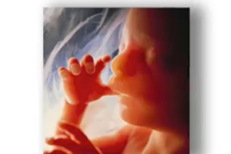 trent-franks-facts-first-2