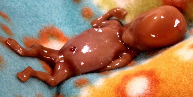 Seeing a baby struggling to survive after abortion could be ‘upsetting,’ says instructional video image