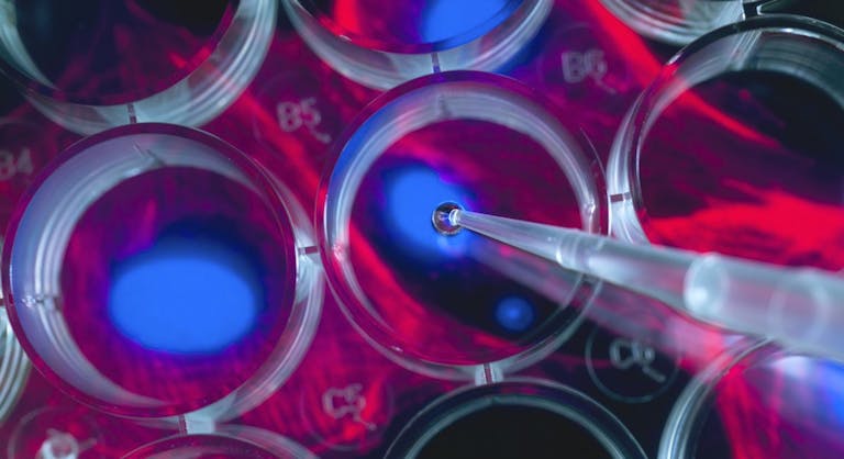 stem cell
