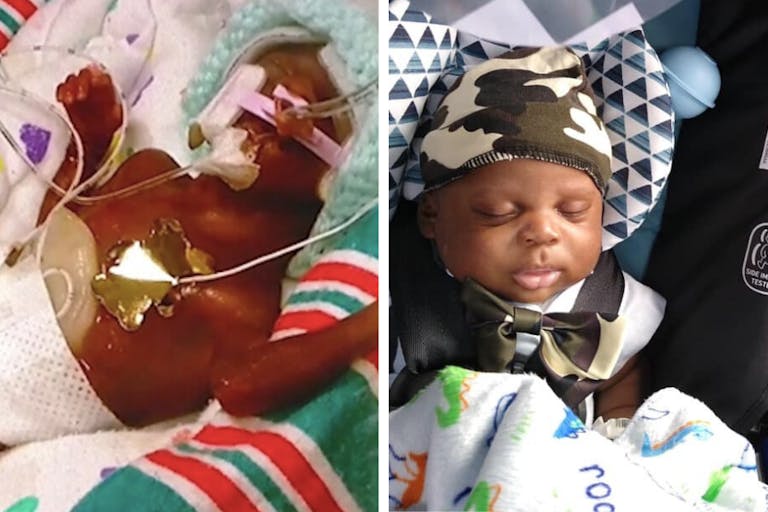 Jemarius Harbor Jr., premature, preemie
