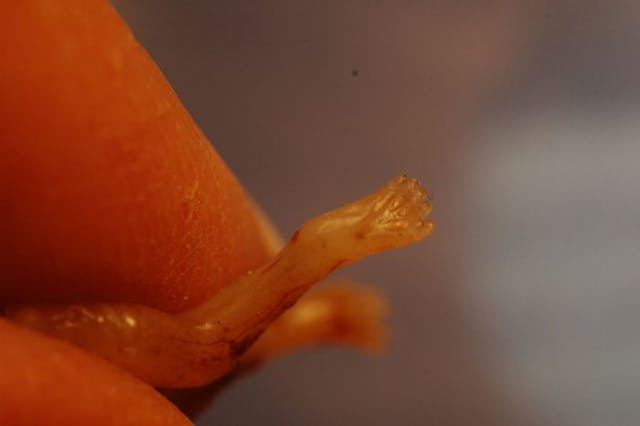 I’ve seen the result of legalized abortion, and it’s nothing to celebrate image