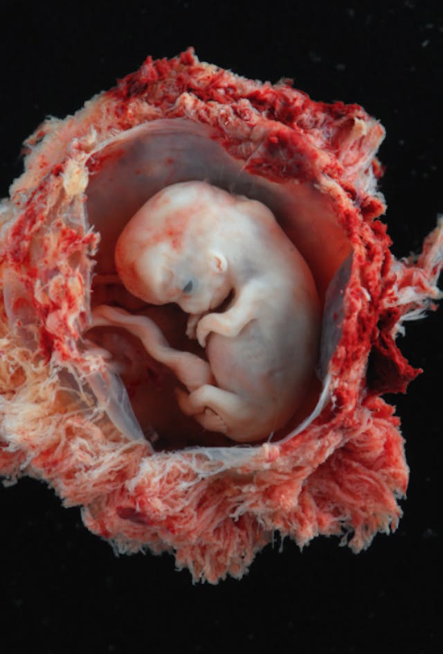 8 weeks from conception FRONTLINE’s ‘The Abortion Divide’ shows abortion is just as painful decades later image
