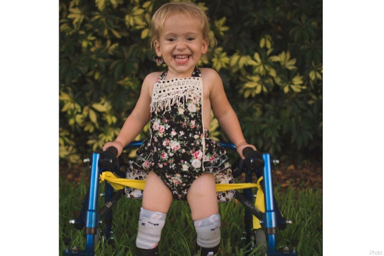 spina bifida